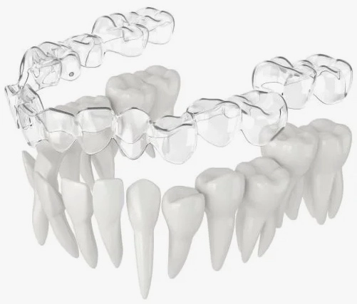 Alinhador invisível Alinhador invisível